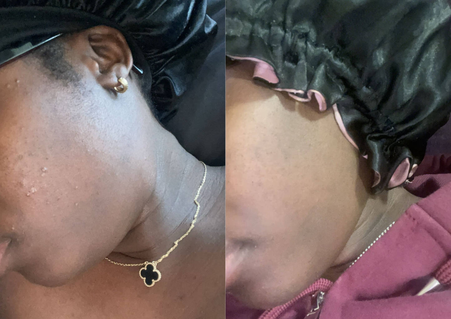 TURMERIC AND LEMON SOAP BAR